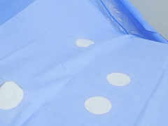 Les résultats de l'analyse de l' angiographie